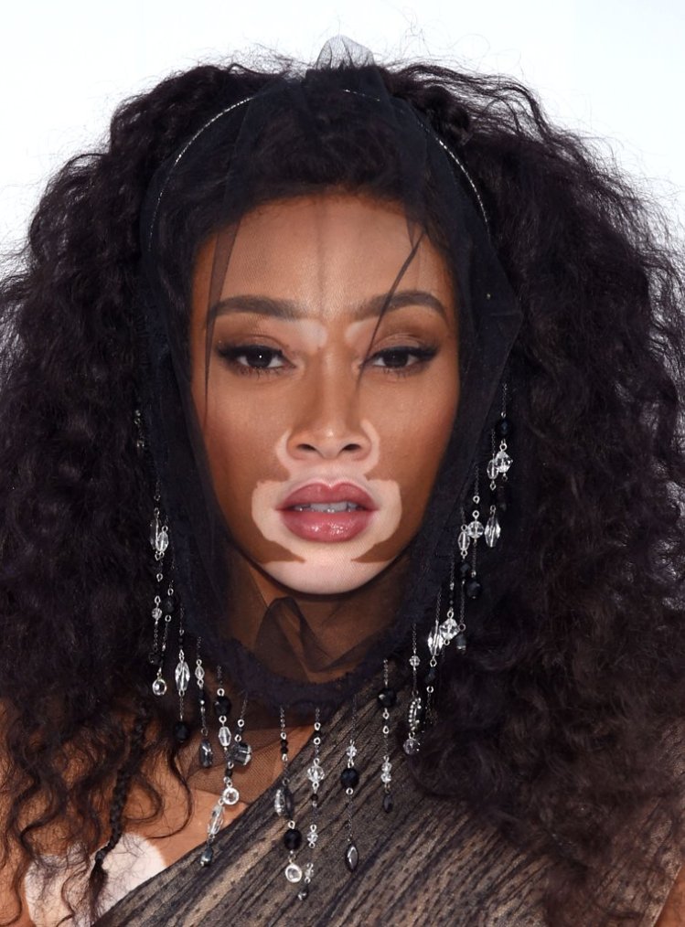 winnie-harlow